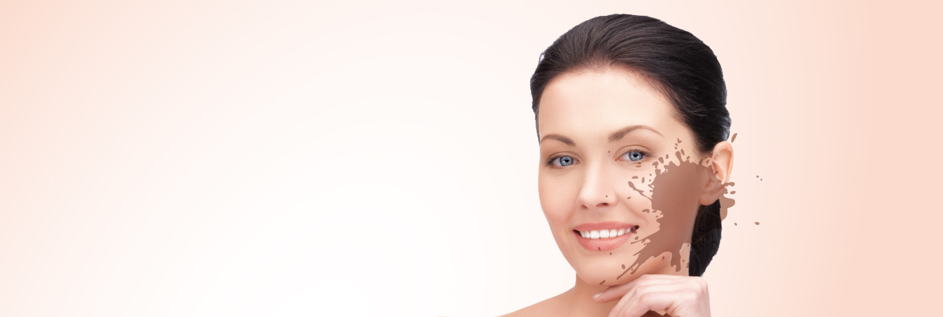 Лазерное лечение гиперпигментации