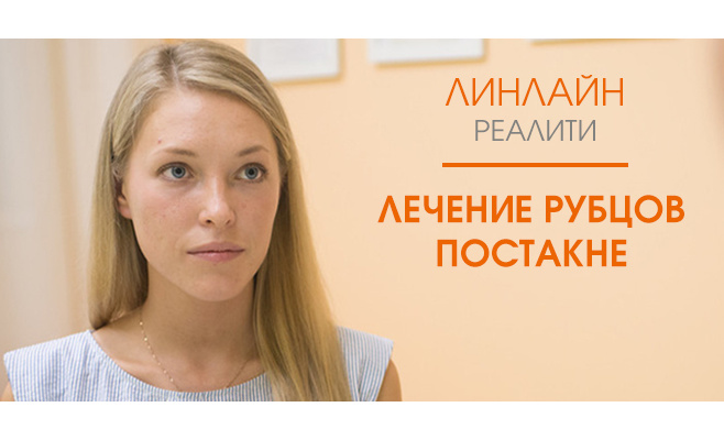 Лазерное лечение рубцов постакне. Проект ЛИНЛАЙН-реалити Лазерное лечение рубцов постакне. Проект ЛИНЛАЙН-реалити