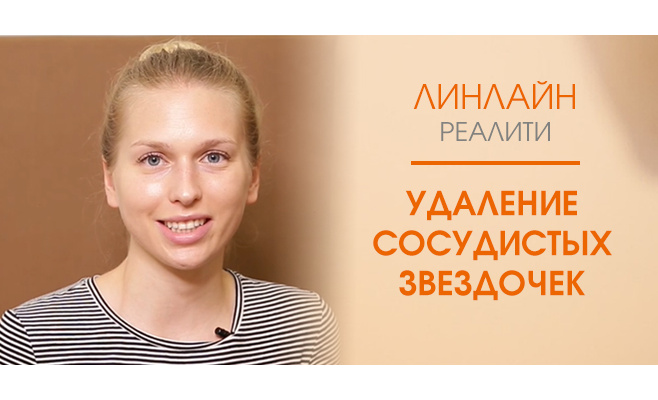 Удаление сосудистых звездочек лазером Удаление сосудистых звездочек лазером