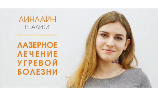 Лечение угревой болезни лазером. Проект ЛИНЛАЙН-реалити Лечение угревой болезни лазером. Проект ЛИНЛАЙН-реалити