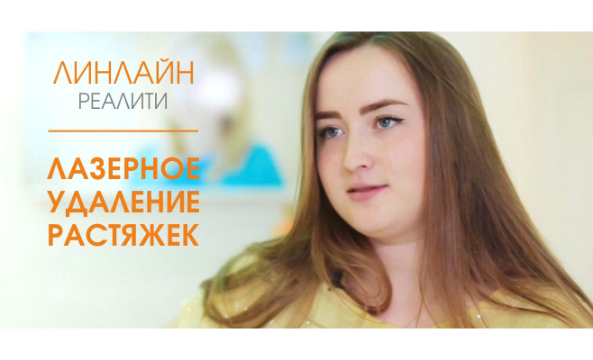 Удаление растяжек лазером. В проекте ЛИНЛАЙН-реалити Удаление растяжек лазером. В проекте ЛИНЛАЙН-реалити